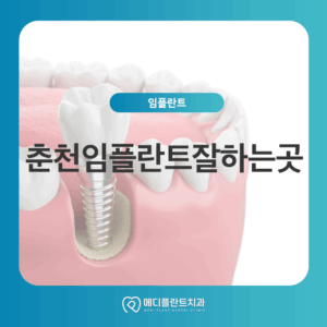 춘천임플란트잘하는곳