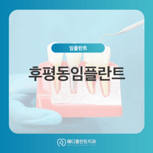 후평동임플란트