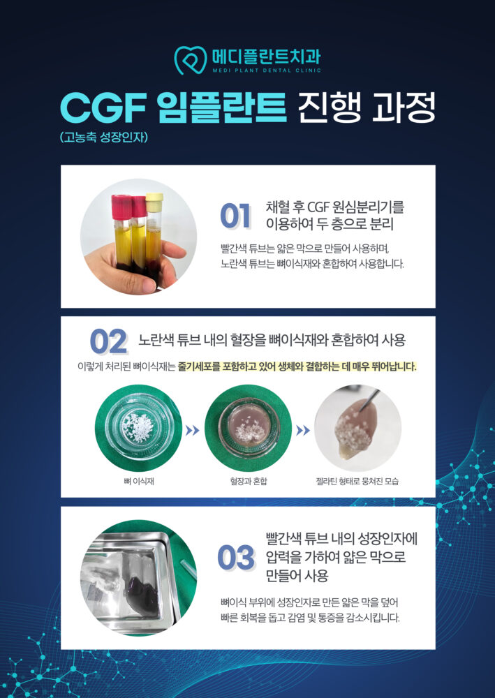 춘천수면치과