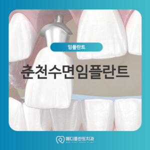춘천수면임플란트