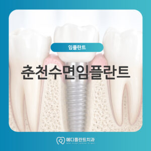 춘천수면임플란트