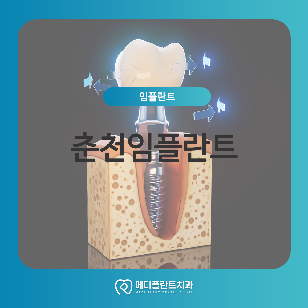 춘천임플란트