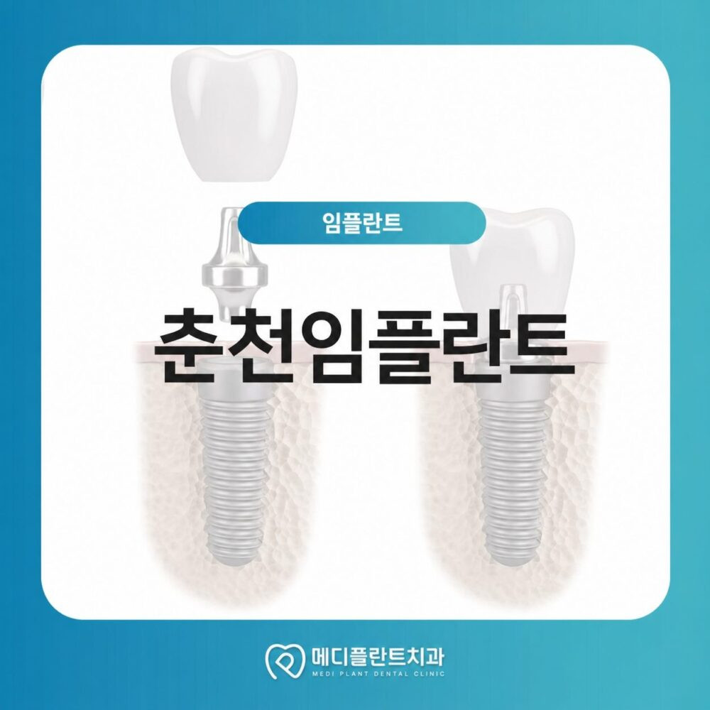 춘천임플란트 디지털 방식 정밀 진행 전 노화 생활습관 법랑질 마모 구강 건강 확인 기준
