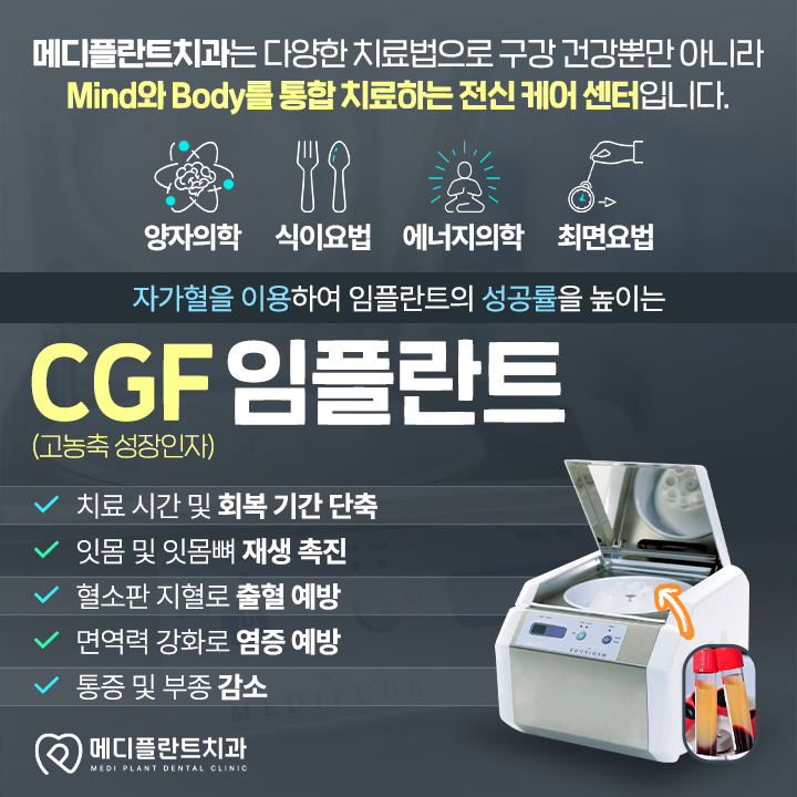 상실한 치아 기능을 회복하는 임플란트 치료 과정